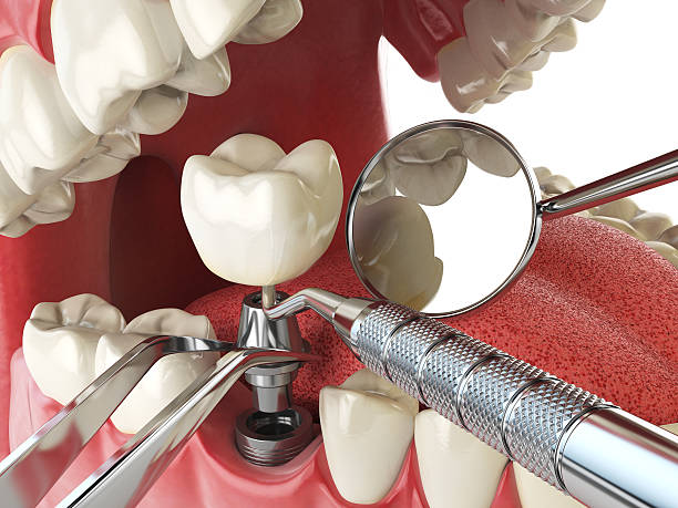 Best Emergency TMJ Treatment in Farngton, MI